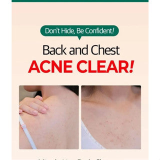 AHA BHA PHA 30 Days Miracle Acne Clear Body Cleanser