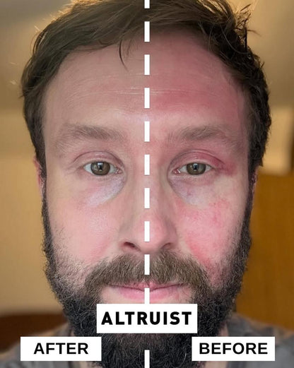 Anti-Redness &amp; Pigmentation Sunscreen SPF 50