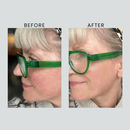 Anti-Redness &amp; Pigmentation Light Sunscreen SPF 50