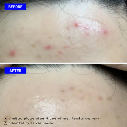 Oat Milk PHA Serum