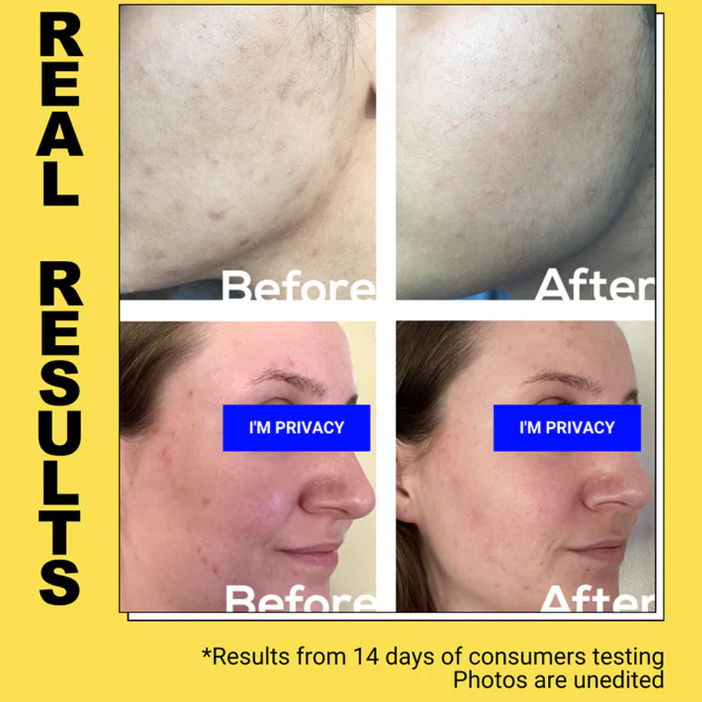 Turmeric Hesperidin Fading Serum